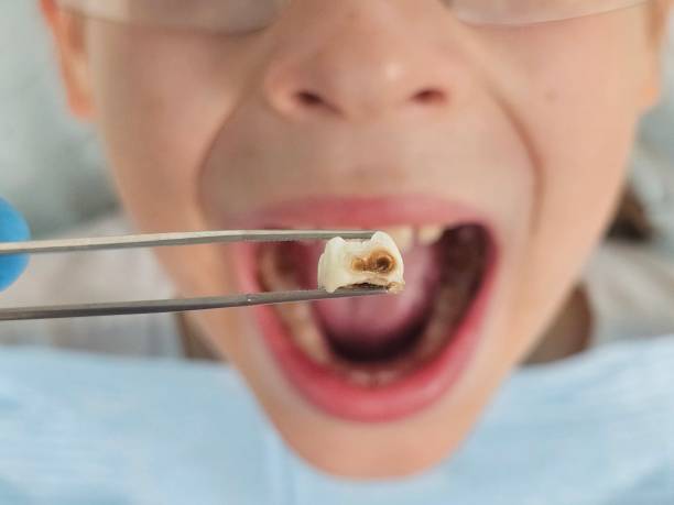 Best Emergency Denture Repair in Falmouth, KY